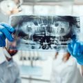 How the Affordable Care Act Has Impacted Dental and Vision Insurance in the US