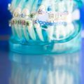 Dental Insurance 101: Navigating Networks, Premiums, and Copays