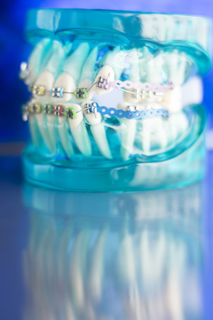 Dental Insurance 101: Navigating Networks, Premiums, and Copays